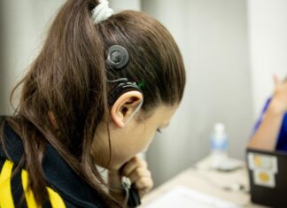 DIF Tamaulipas calibra implantes cocleares